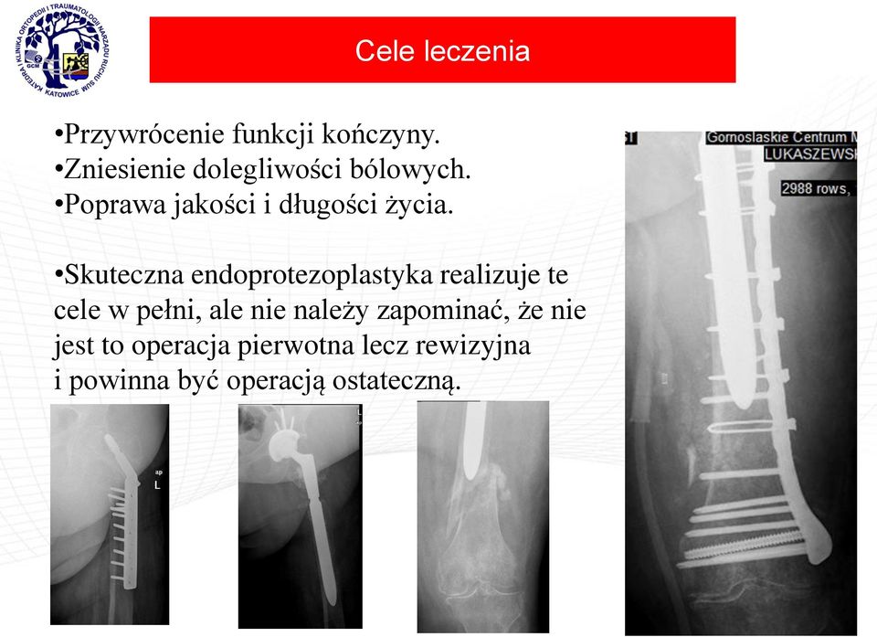 Skuteczna endoprotezoplastyka realizuje te cele w pełni, ale nie