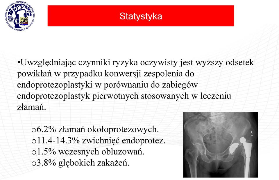 endoprotezoplastyk pierwotnych stosowanych w leczeniu złamań. o6.