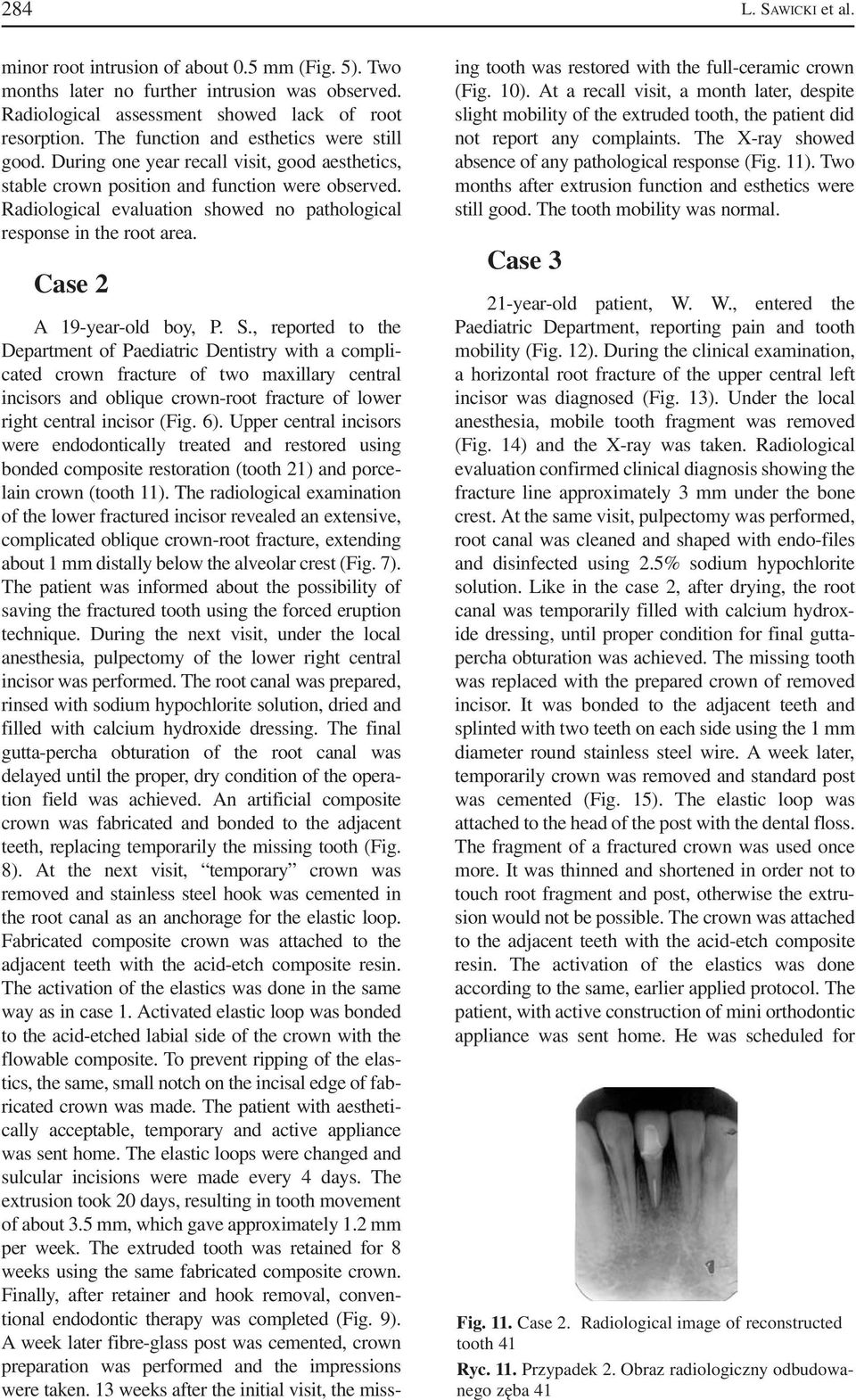 Radiological evaluation showed no pathological response in the root area. Case 2 A 19 year old boy, P. S.