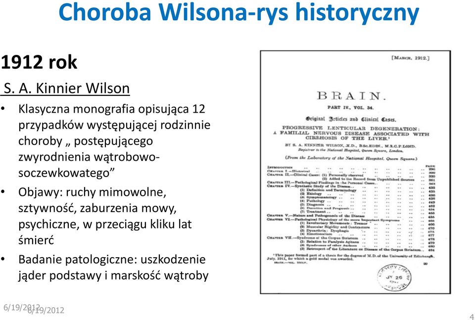 postępującego zwyrodnienia wątrobowosoczewkowatego Objawy: ruchy mimowolne, sztywność,