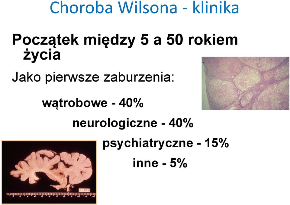 pierwsze zaburzenia: wątrobowe - 40%