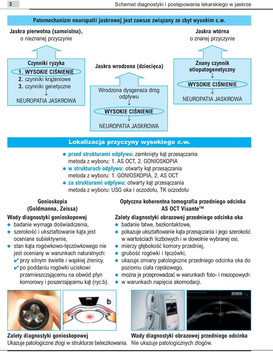 czynniki genetyczne NEUROPATIA JASKROWA Jaskra wrodzona (dzieci ca) Wrodzona dysgeneza dróg odp ywu WYSOKIE CIÂNIENIE NEUROPATIA JASKROWA Znany czynnik etiopatogenetyczny WYSOKIE CIÂNIENIE NEUROPATIA