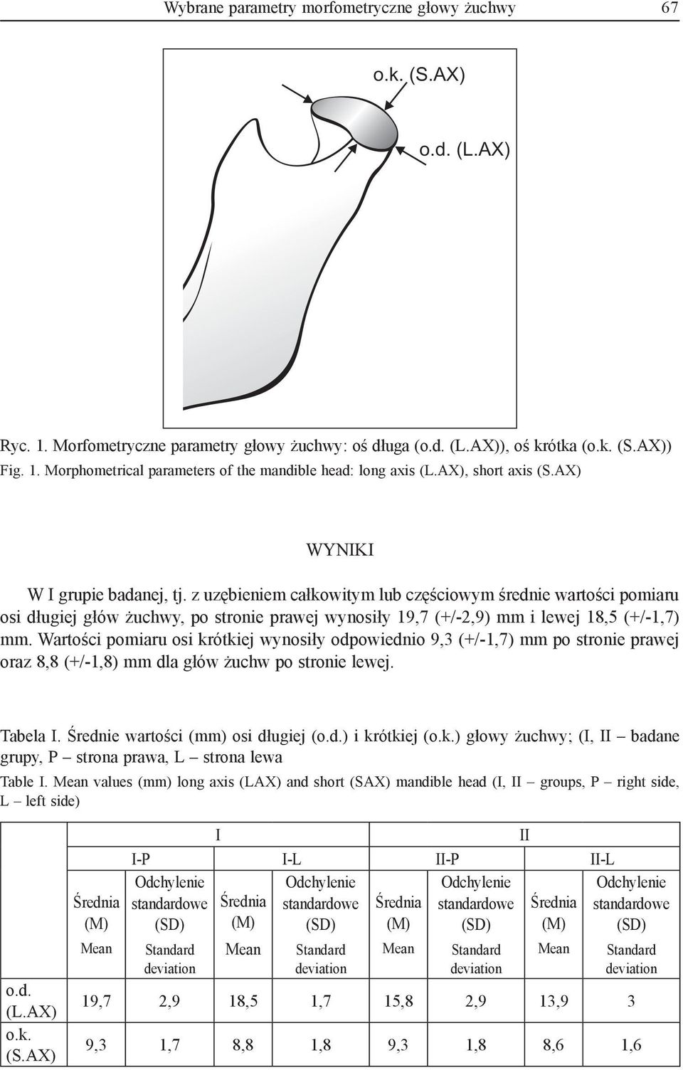 z uzębieniem całkowitym lub częściowym średnie wartości pomiaru osi długiej głów żuchwy, po stronie prawej wynosiły 19,7 (+/-2,9) mm i lewej 18,5 (+/-1,7) mm.