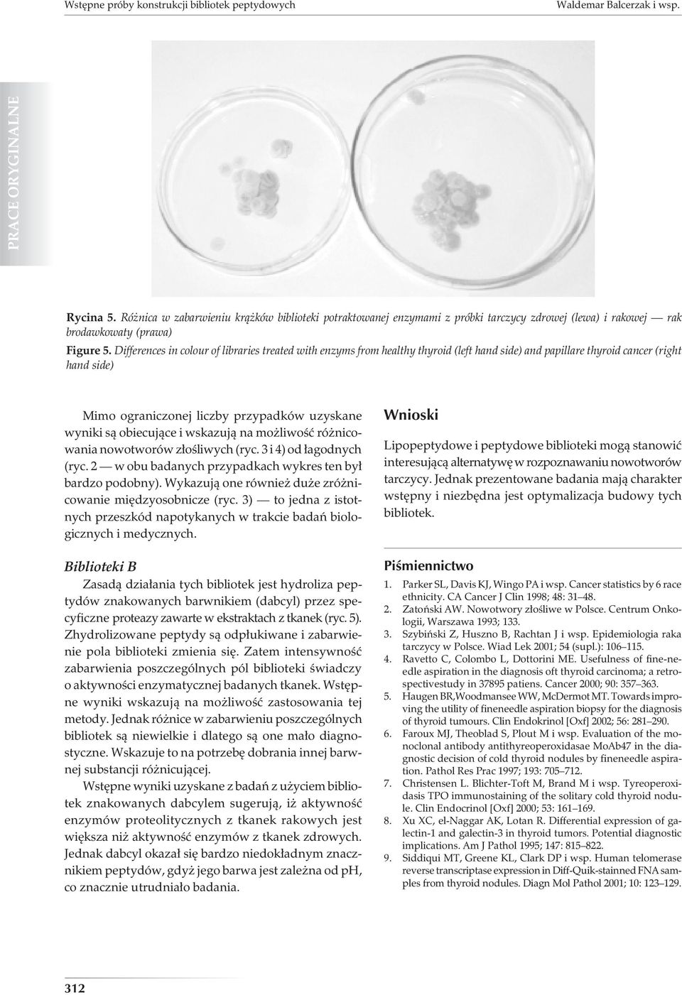 Differences in colour of libraries treated with enzyms from healthy thyroid (left hand side) and papillare thyroid cancer (right hand side) Mimo ograniczonej liczby przypadków uzyskane wyniki są