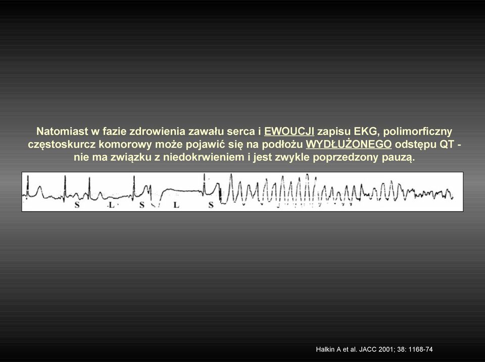 WYDŁUŻONEGO odstępu QT nie ma związku z niedokrwieniem i jest