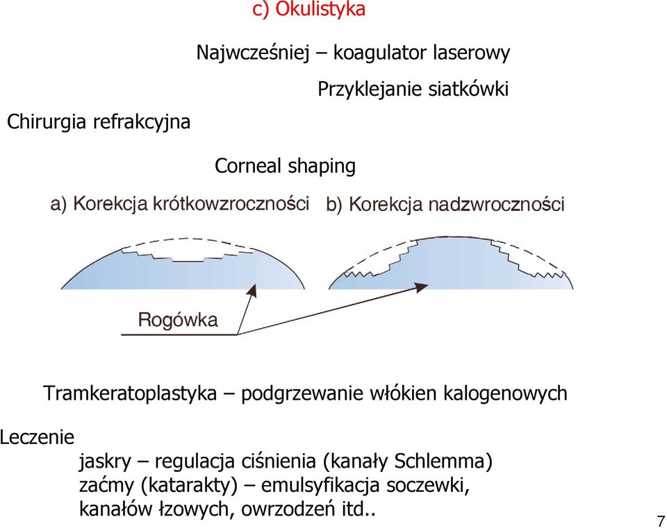 włókien kalogenowych Leczenie jaskry regulacja ciśnienia (kanały