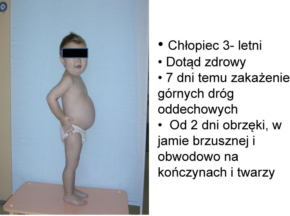 oddechowych Od 2 dni obrzęki, w