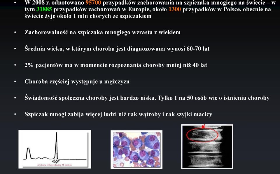 obecnie na świecie żyje około 1 mln chorych ze szpiczakiem Zachorowalność na szpiczaka mnogiego wzrasta z wiekiem Średnia wieku, w którym choroba jest