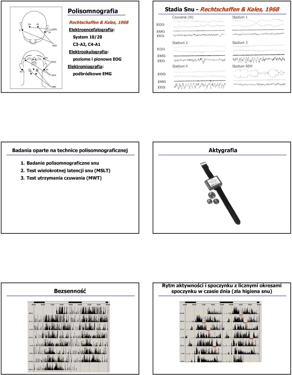 Elektromiografia: podbródkowe EMG Stadium 4 Stadium REM EMG Badania oparte na technice polisomnograficznej Aktygrafia 1.