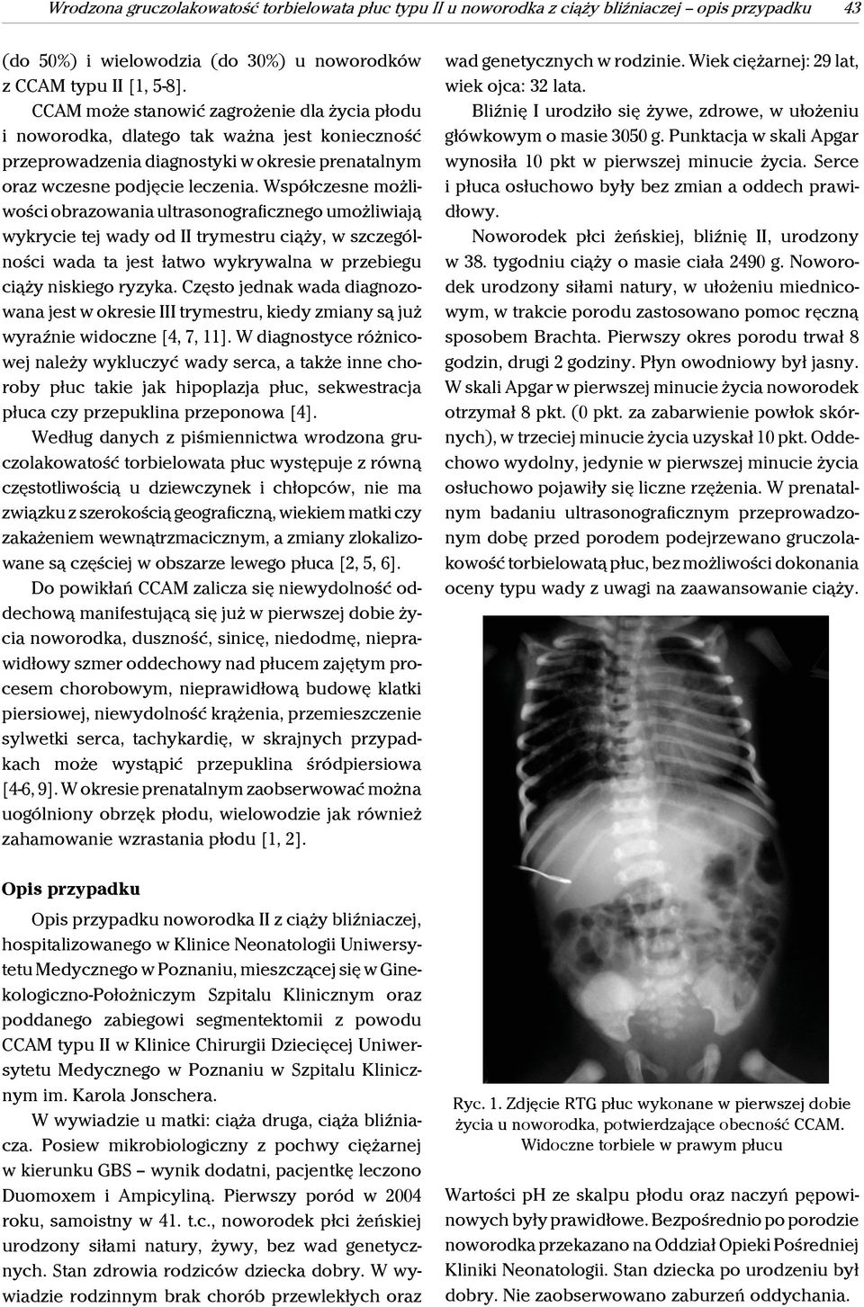 Współczesne możliwości obrazowania ultrasonograficznego umożliwiają wykrycie tej wady od II trymestru ciąży, w szczególności wada ta jest łatwo wykrywalna w przebiegu ciąży niskiego ryzyka.