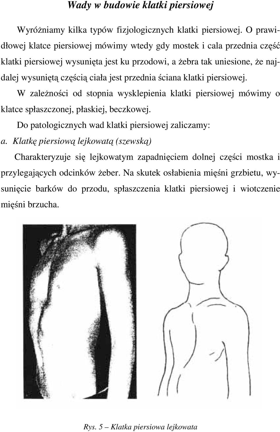 przednia ściana klatki piersiowej. W zależności od stopnia wysklepienia klatki piersiowej mówimy o klatce spłaszczonej, płaskiej, beczkowej.