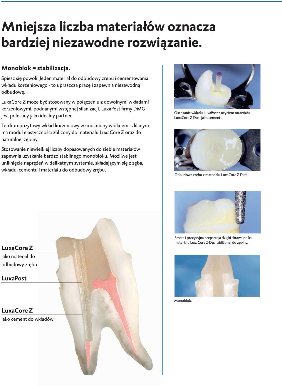 LuxaCore Z może być stosowany w połączeniu z dowolnymi wkładami korzeniowymi, poddanymi wstępnej silanizacji. LuxaPost firmy DMG jest polecany jako idealny partner.