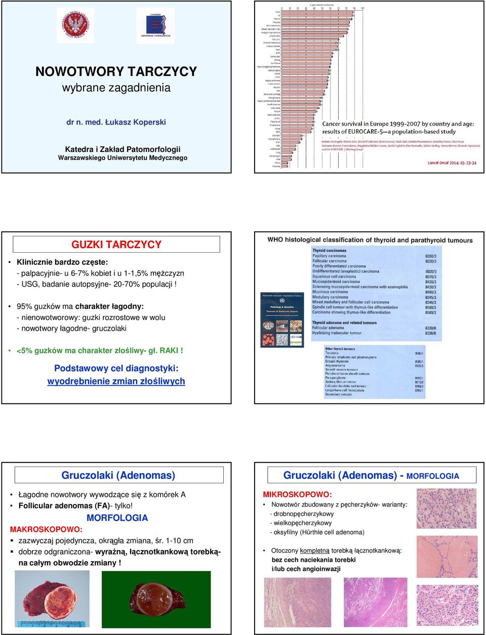 autopsyjne- 20-70% populacji! 95% guzków ma charakter łagodny: - nienowotworowy: guzki rozrostowe w wolu - nowotwory łagodne- gruczolaki <5% guzków ma charakter złośliwy- gł. RAKI!