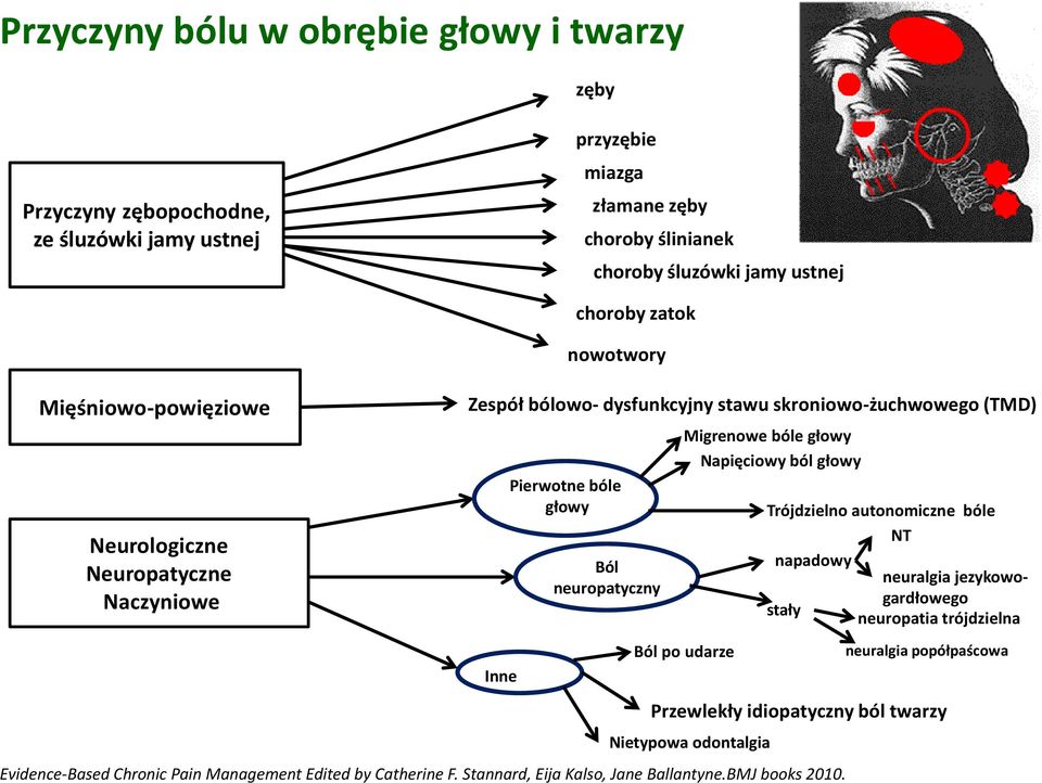 Migrenowe bóle głowy Napięciowy ból głowy Trójdzielno autonomiczne bóle NT napadowy neuralgia jezykowogardłowego stały neuropatia trójdzielna Inne Ból po udarze neuralgia