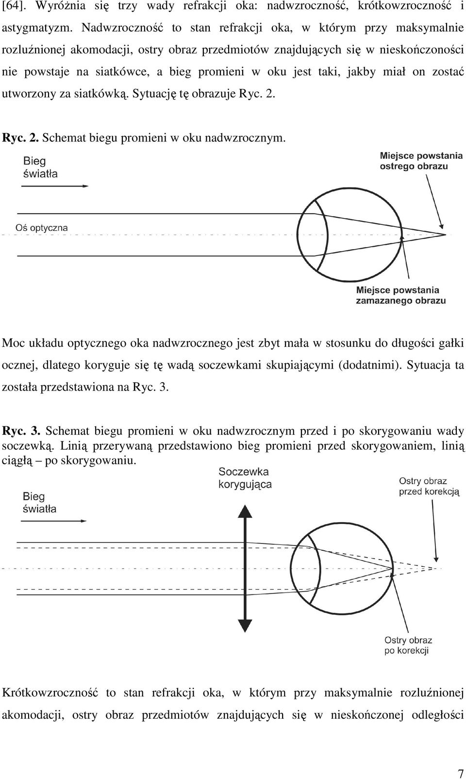 jest taki, jakby miał on zostać utworzony za siatkówką. Sytuację tę obrazuje Ryc. 2. Ryc. 2. Schemat biegu promieni w oku nadwzrocznym.