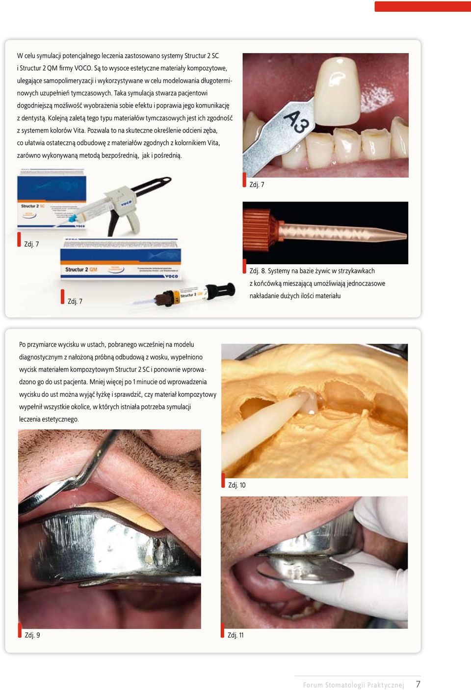 Taka symulacja stwarza pacjentowi dogodniejszą możliwość wyobrażenia sobie efektu i poprawia jego komunikację z dentystą.