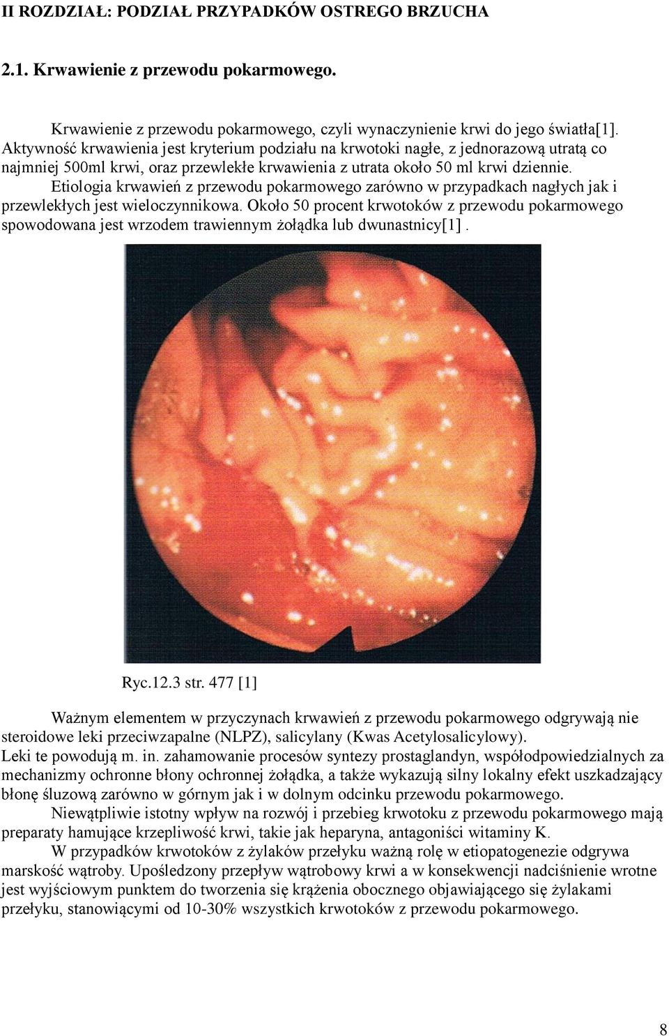 Etiologia krwawień z przewodu pokarmowego zarówno w przypadkach nagłych jak i przewlekłych jest wieloczynnikowa.