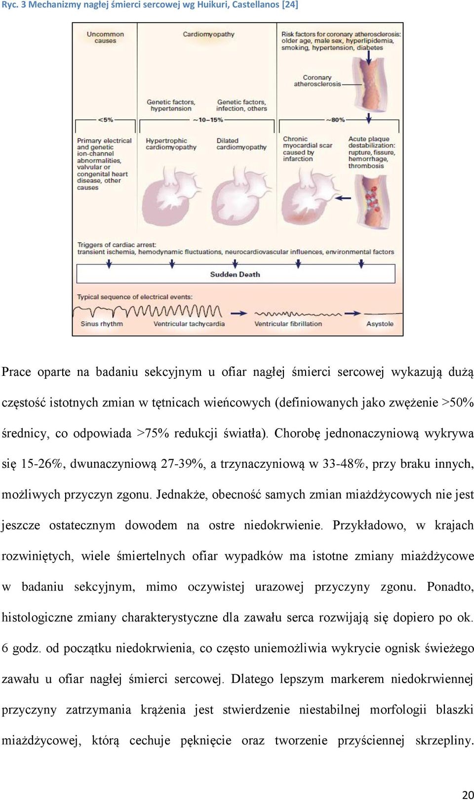 Chorobę jednonaczyniową wykrywa się 15-26%, dwunaczyniową 27-39%, a trzynaczyniową w 33-48%, przy braku innych, możliwych przyczyn zgonu.