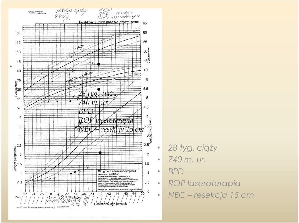 resekcja 15 cm. 28 tyg.