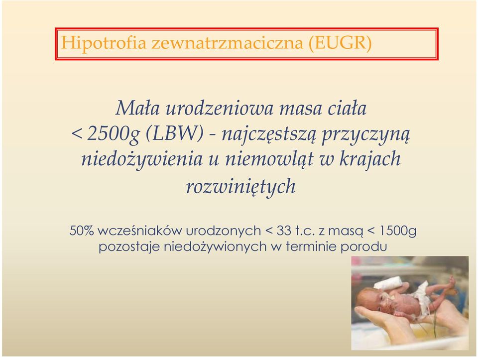 niemowląt w krajach rozwiniętych 50% wcześniaków urodzonych