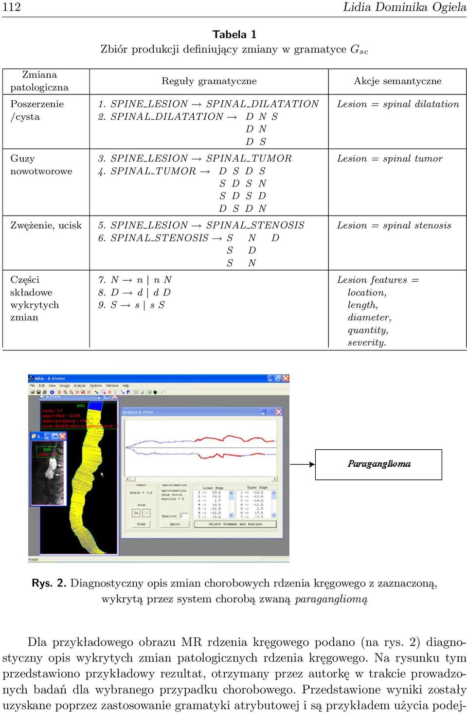 SPINAL STENOSIS S N D S D S N 7. N n nn 8. D d dd 9.