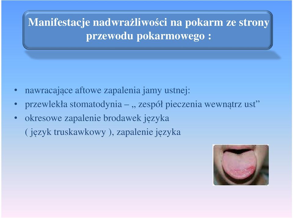 przewlekła stomatodynia zespół pieczenia wewnątrz ust