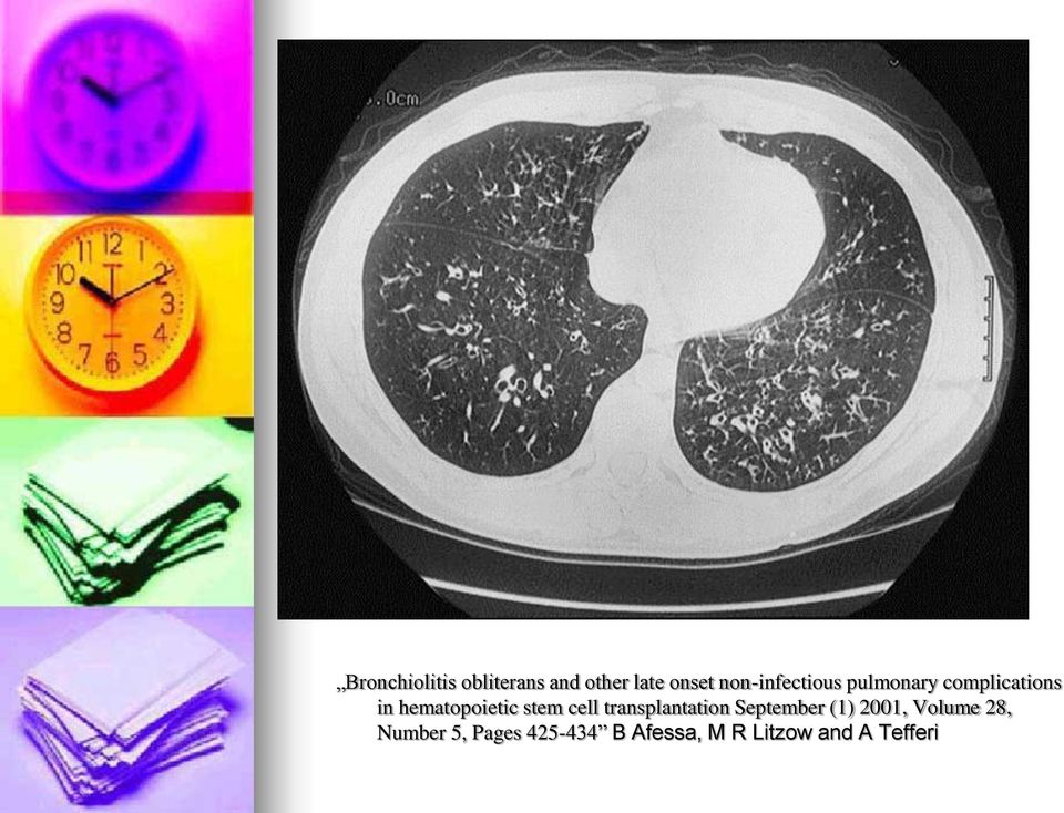 hematopoietic stem cell transplantation September (1)