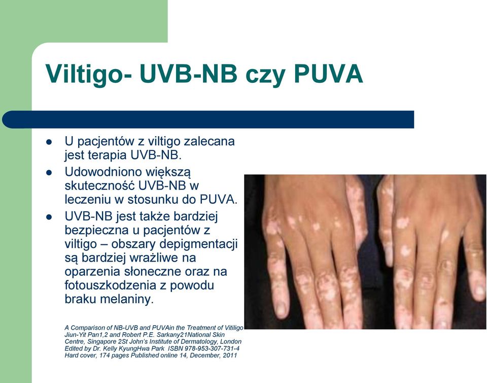 powodu braku melaniny. A Comparison of NB-UVB and PUVAin the Treatment of Vitiligo Jiun-Yit Pan1,2 and Robert P.E.