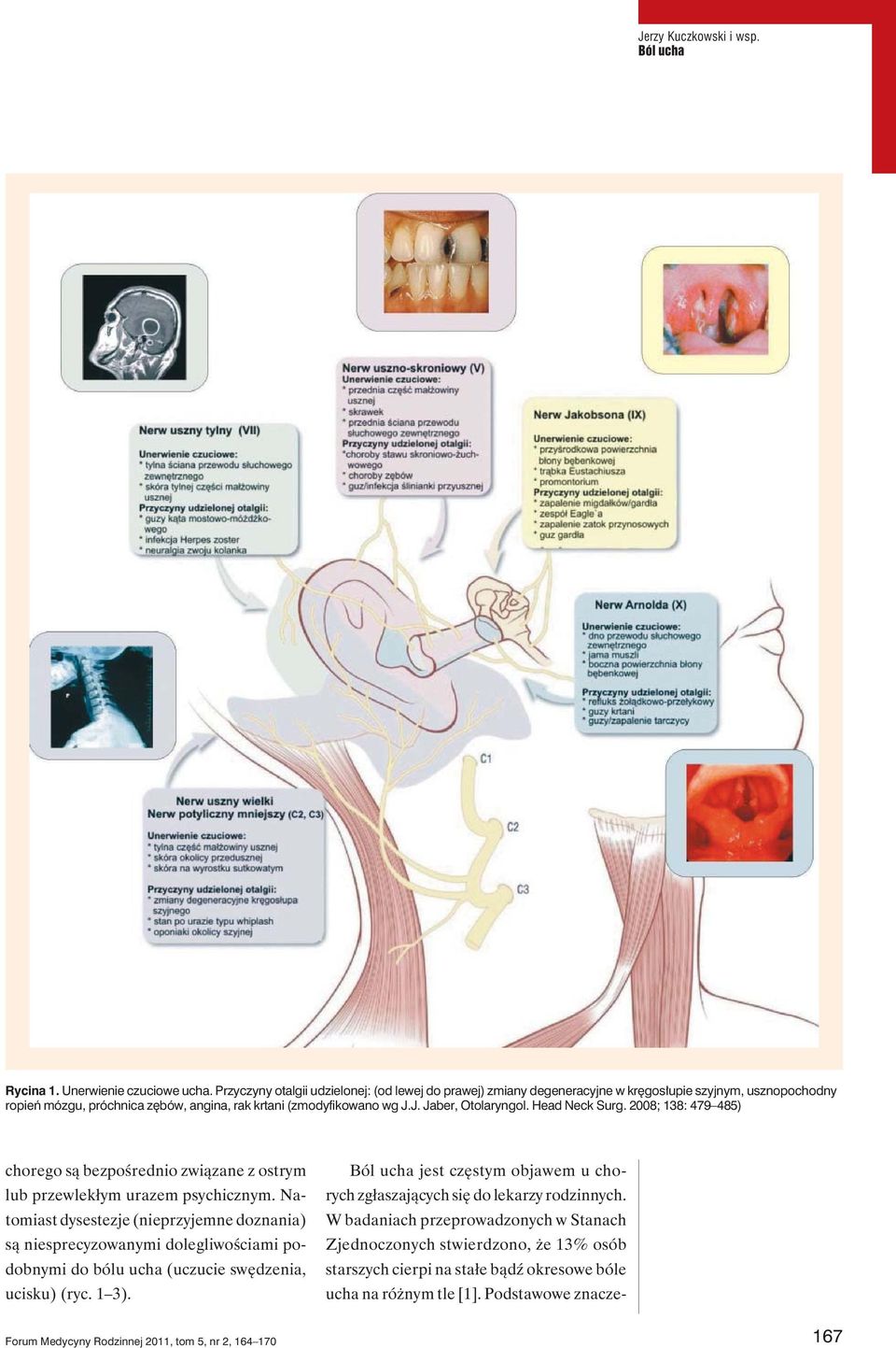 J. Jaber, Otolaryngol. Head Neck Surg. 2008; 138: 479 485) chorego są bezpośrednio związane z ostrym lub przewlekłym urazem psychicznym.