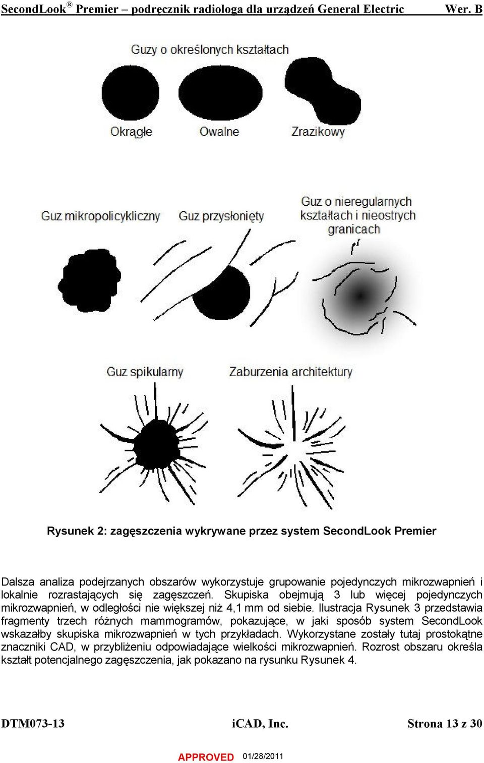 Ilustracja Rysunek 3 przedstawia fragmenty trzech różnych mammogramów, pokazujące, w jaki sposób system SecondLook wskazałby skupiska mikrozwapnień w tych przykładach.