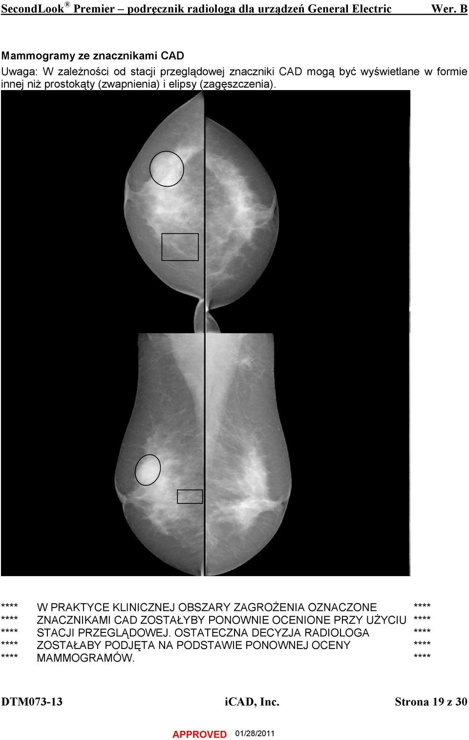 **** W PRAKTYCE KLINICZNEJ OBSZARY ZAGROŻENIA OZNACZONE **** **** ZNACZNIKAMI CAD ZOSTAŁYBY PONOWNIE OCENIONE PRZY