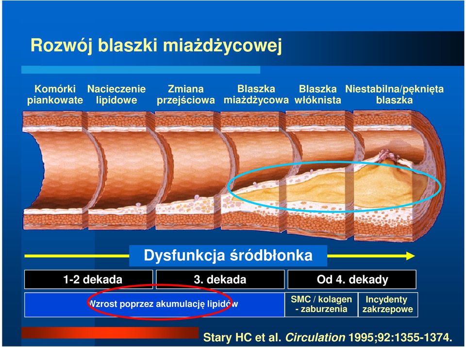 Dysfunkcja śródbłonka 1-2 dekada 3. dekada Od 4.