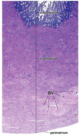 Macica Błona śluzowa (endometrium) nabłonek jednowarstwowy walcowaty blaszka właściwa błony śluzowej