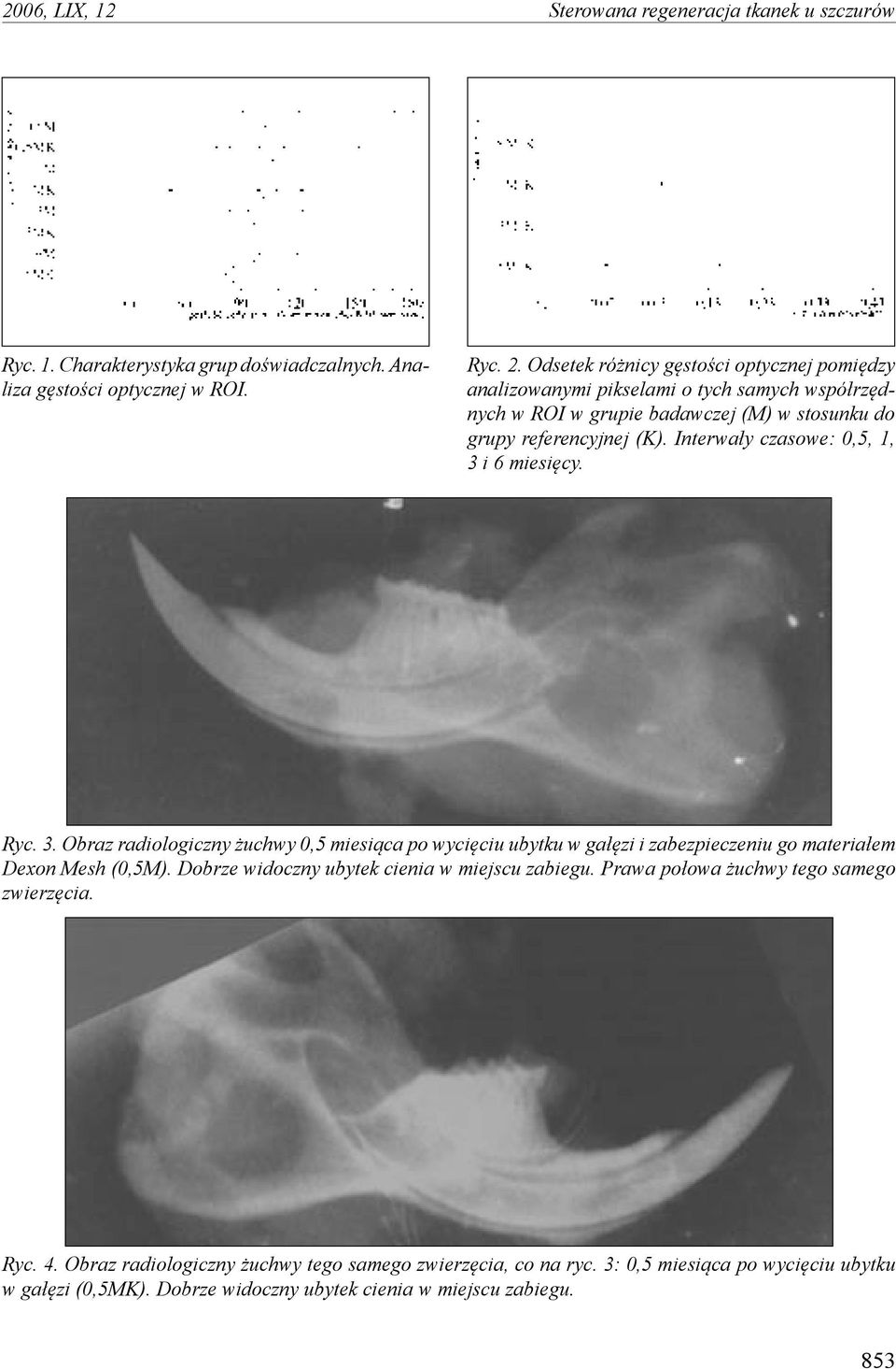 Interwały czasowe: 0,5, 1, 3 i 6 miesięcy. Ryc. 3. Obraz radiologiczny żuchwy 0,5 miesiąca po wycięciu ubytku w gałęzi i zabezpieczeniu go materiałem Dexon Mesh (0,5M).