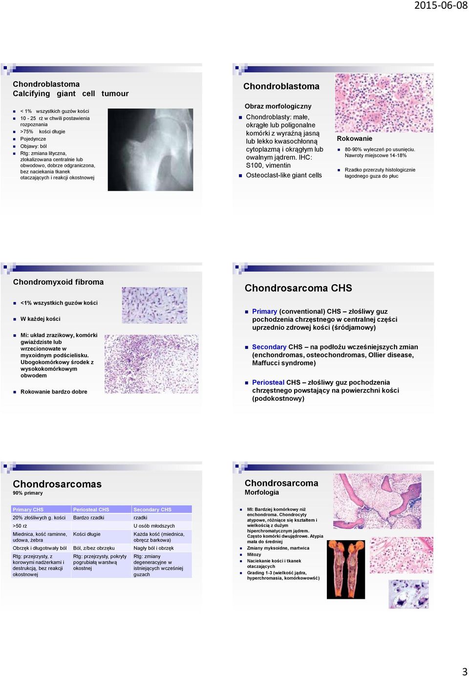 wyraźną jasną lub lekko kwasochłonną cytoplazmą i okrągłym lub owalnym jądrem. IHC: S100, vimentin Osteoclast-like giant cells Rokowanie 80-90% wyleczeń po usunięciu.