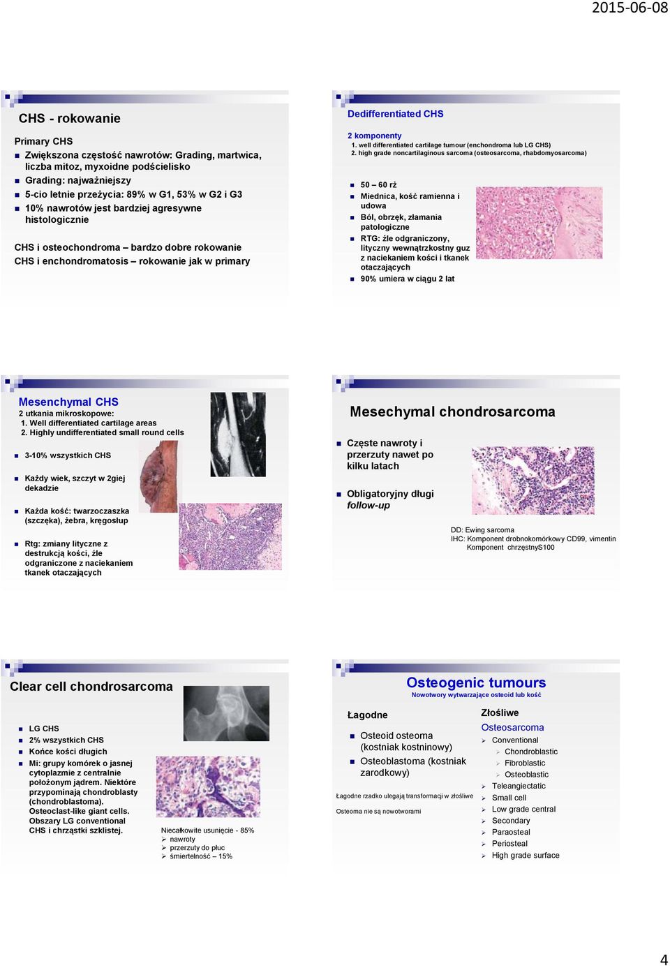 well differentiated cartilage tumour (enchondroma lub LG CHS) 2.