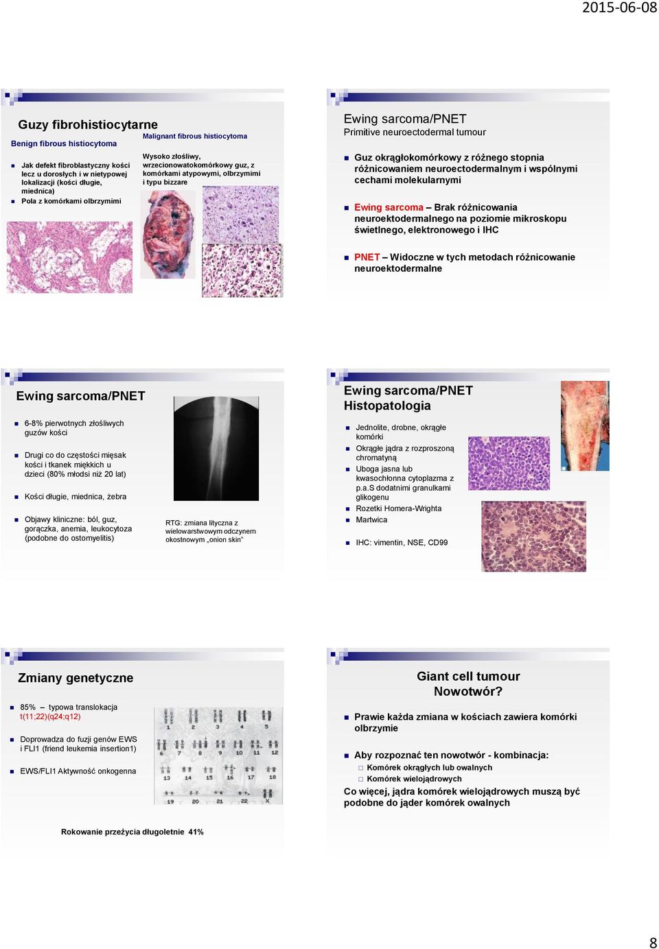 różnicowaniem neuroectodermalnym i wspólnymi cechami molekularnymi Ewing sarcoma Brak różnicowania neuroektodermalnego na poziomie mikroskopu świetlnego, elektronowego i IHC PNET Widoczne w tych