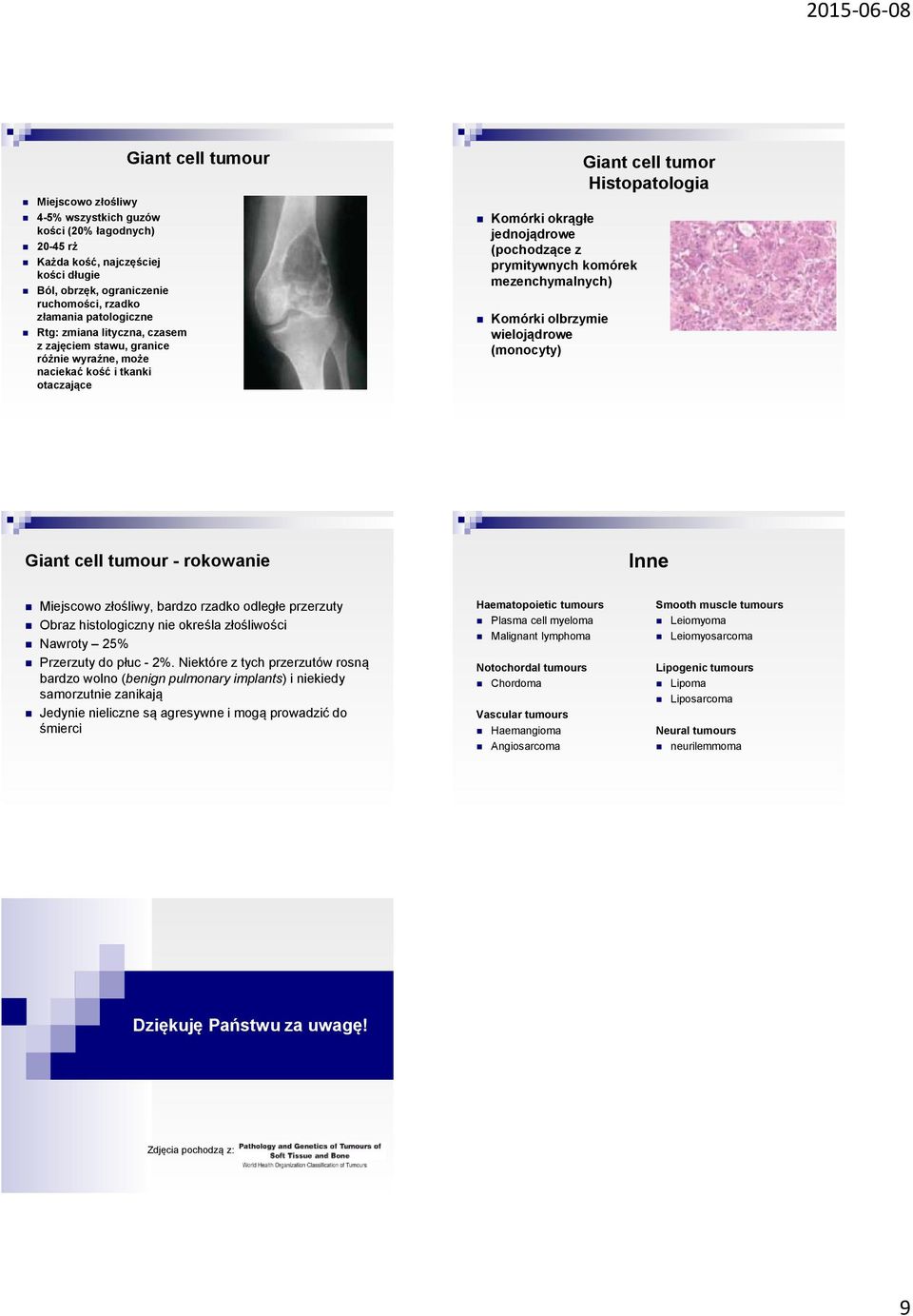 olbrzymie wielojądrowe (monocyty) Giant cell tumor Histopatologia Giant cell tumour - rokowanie Inne Miejscowo złośliwy, bardzo rzadko odległe przerzuty Obraz histologiczny nie określa złośliwości