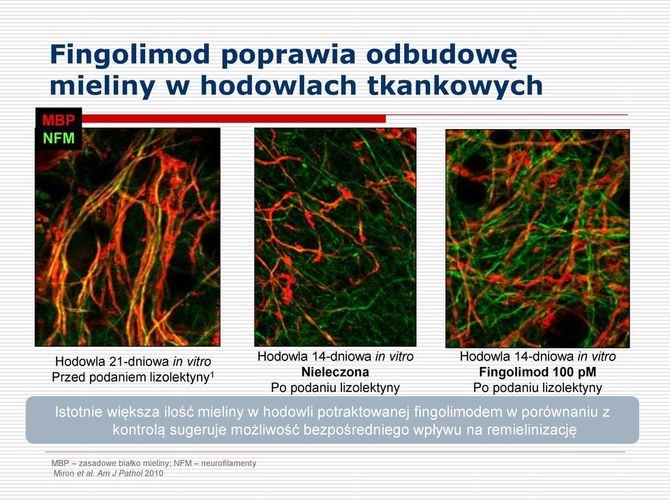 Po podaniu lizolektyny Istotnie większa ilość mieliny w hodowli potraktowanej fingolimodem w porównaniu z kontrolą