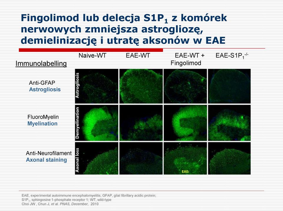 Myelination Anti-Neurofilament Axonal staining EAE, experimental autoimmune encephalomyelitis; GFAP, glial