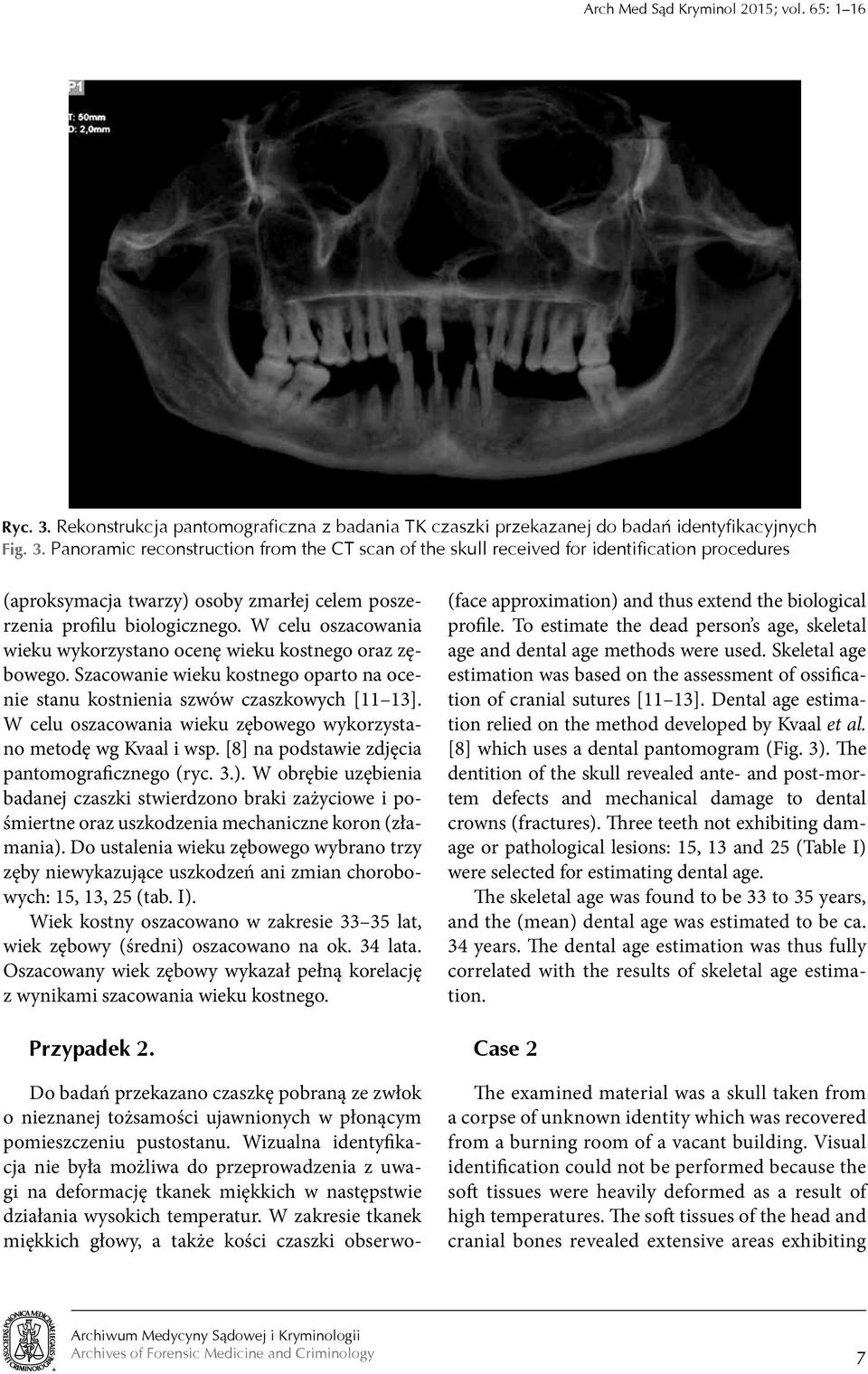 Panoramic reconstruction from the CT scan of the skull received for identification procedures (aproksymacja twarzy) osoby zmarłej celem poszerzenia profilu biologicznego.