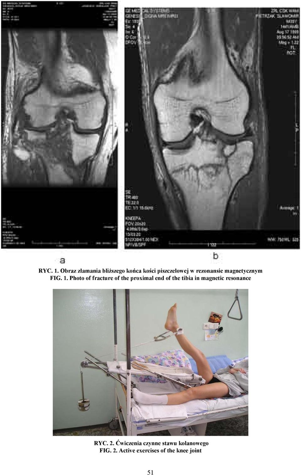 magnetycznym FIG. 1.