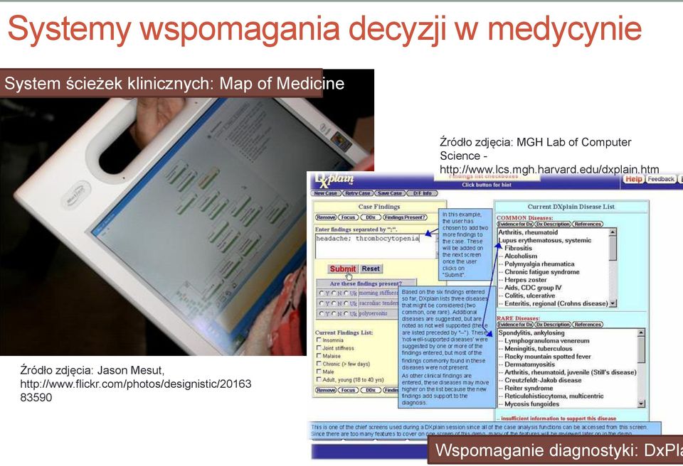 lcs.mgh.harvard.edu/dxplain.htm Źródło zdjęcia: Jason Mesut, http://www.