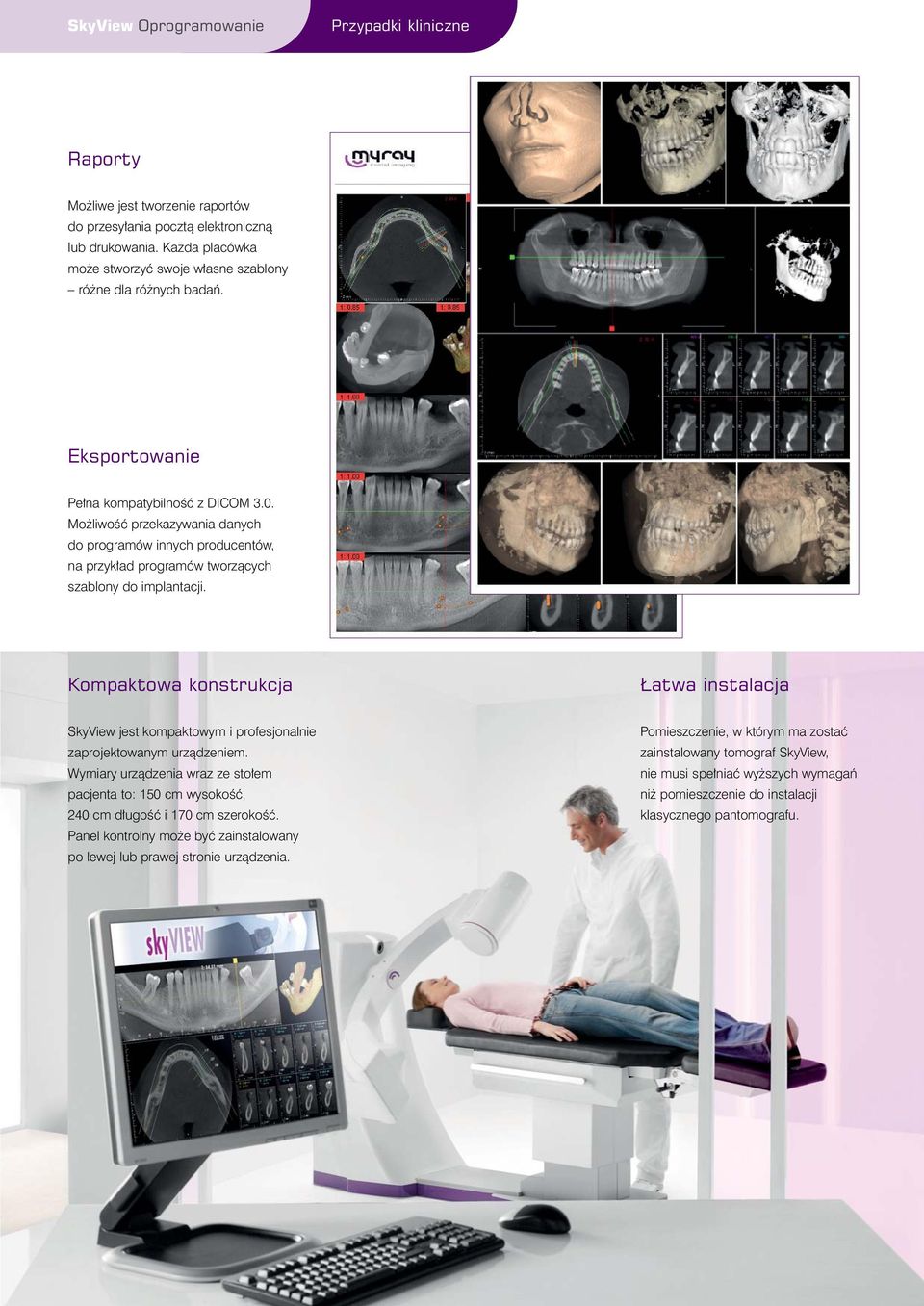 Mo liwoêç przekazywania danych do programów innych producentów, na przyk ad programów tworzàcych szablony do implantacji.