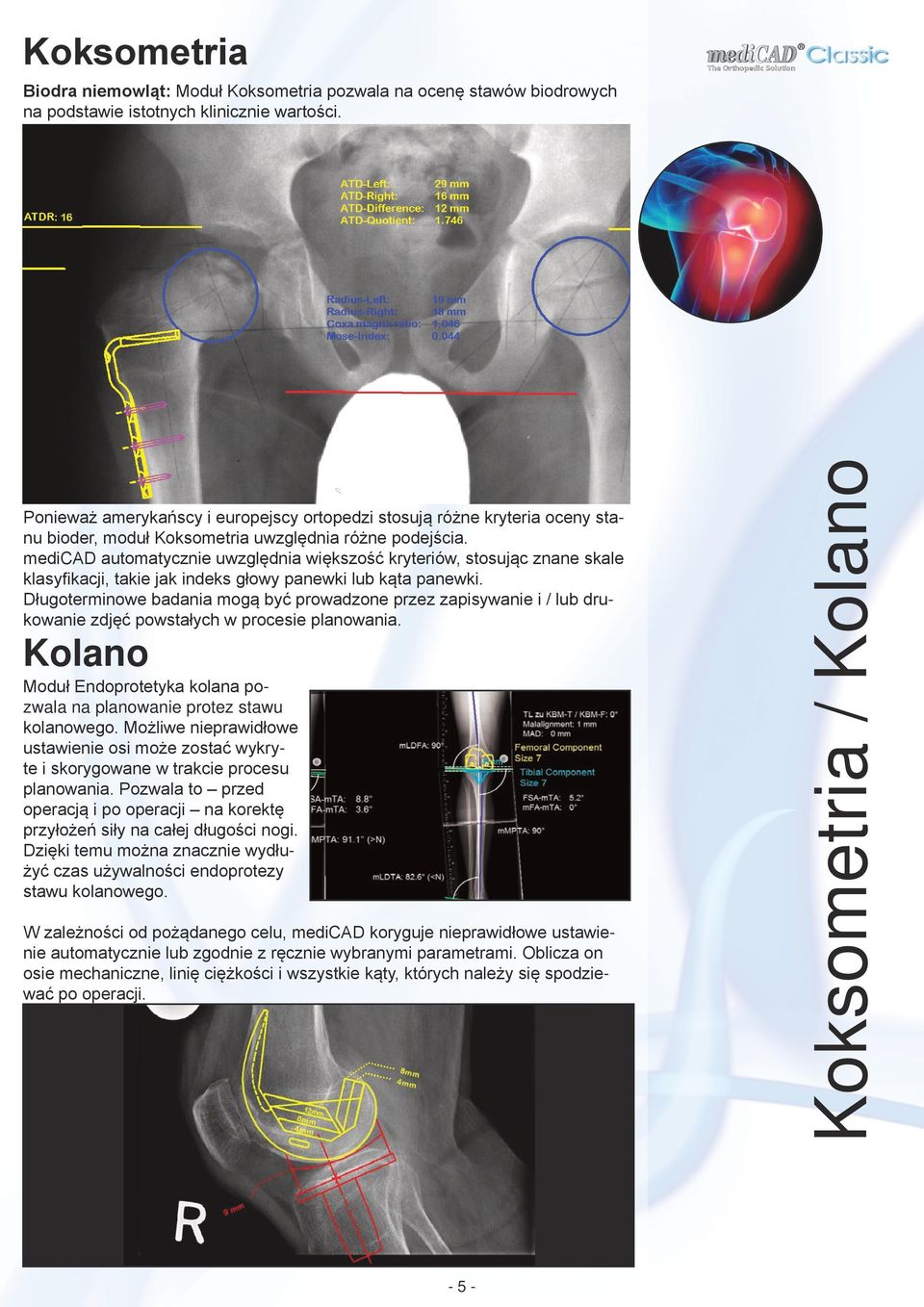 medicad automatycznie uwzględnia większość kryteriów, stosując znane skale klasyfikacji, takie jak indeks głowy panewki lub kąta panewki.