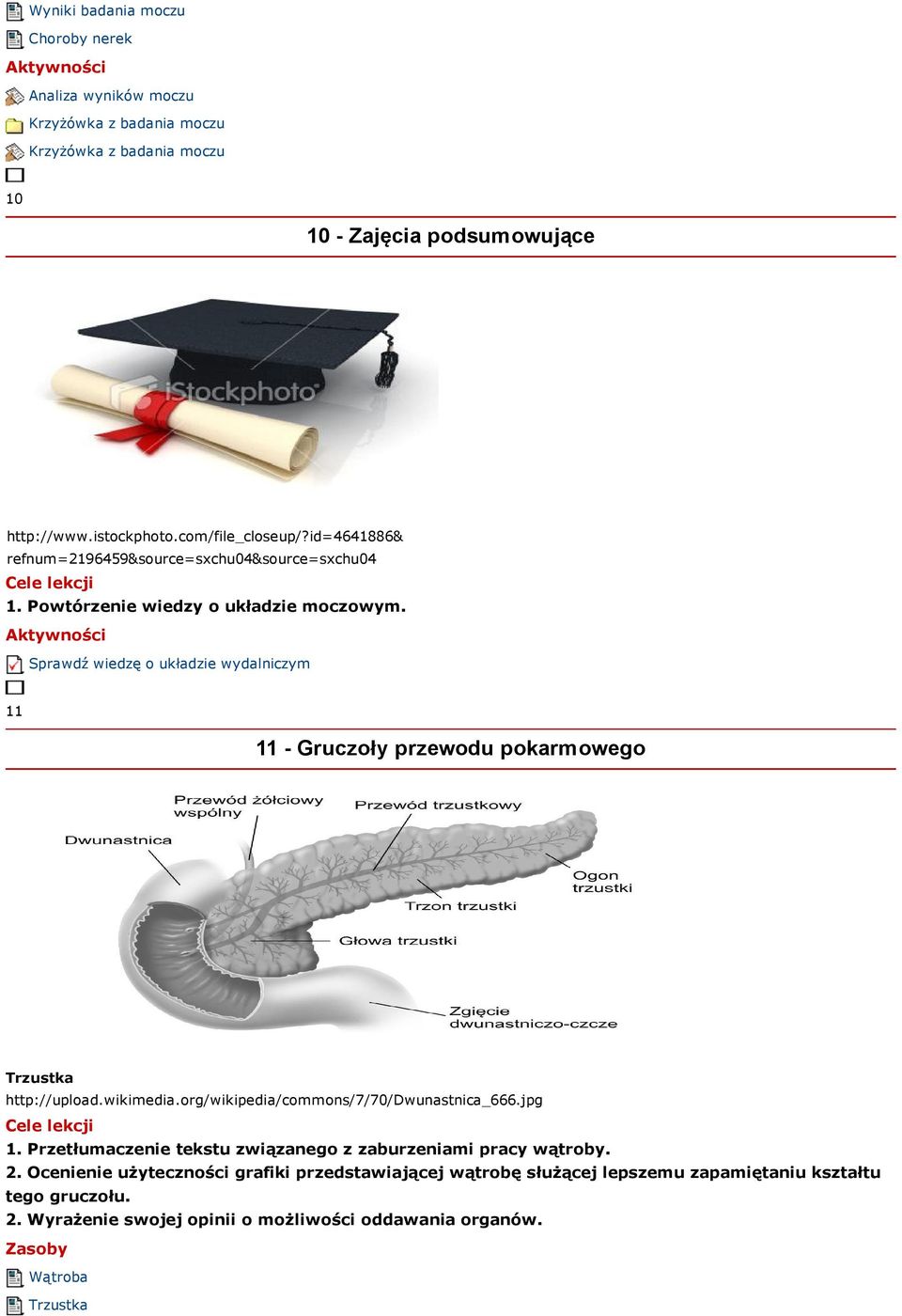 Sprawdź wiedzę o układzie wydalniczym 11 11 - Gruczoły przewodu pokarmowego Trzustka http://upload.wikimedia.org/wikipedia/commons/7/70/dwunastnica_666.jpg 1.