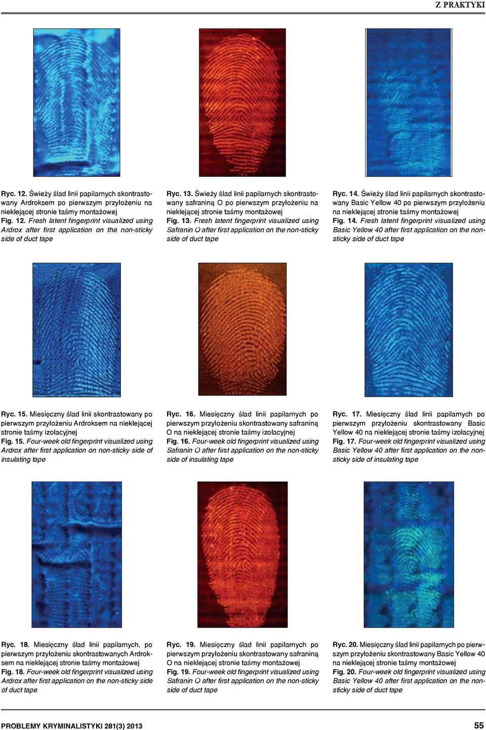 Fresh latent fingerprint visualized using Safranin O after first application on the non-sticky side of duct tape Ryc. 14.