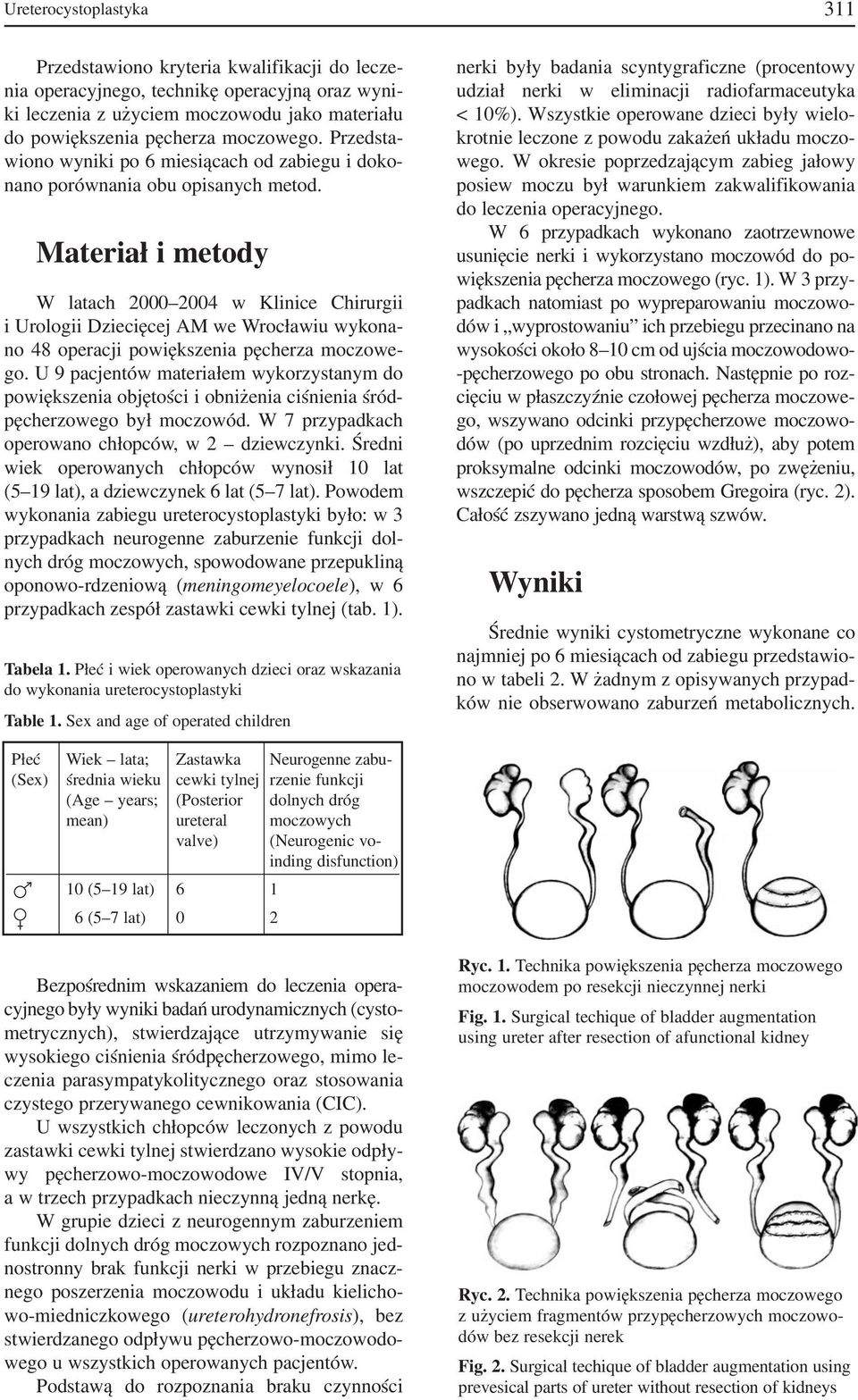 Materiał i metody W latach 2000 2004 w Klinice Chirurgii i Urologii Dziecięcej AM we Wrocławiu wykona no 48 operacji powiększenia pęcherza moczowe go.