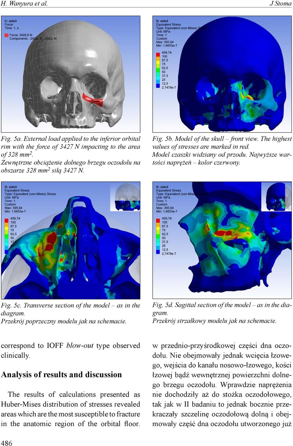 Model czaszki widziany od przodu. Najwyższe wartości naprężeń kolor czerwony. Fig. 5c. Transverse section of the model as in the diagram. Przekrój poprzeczny modelu jak na schemacie. Fig. 5d.