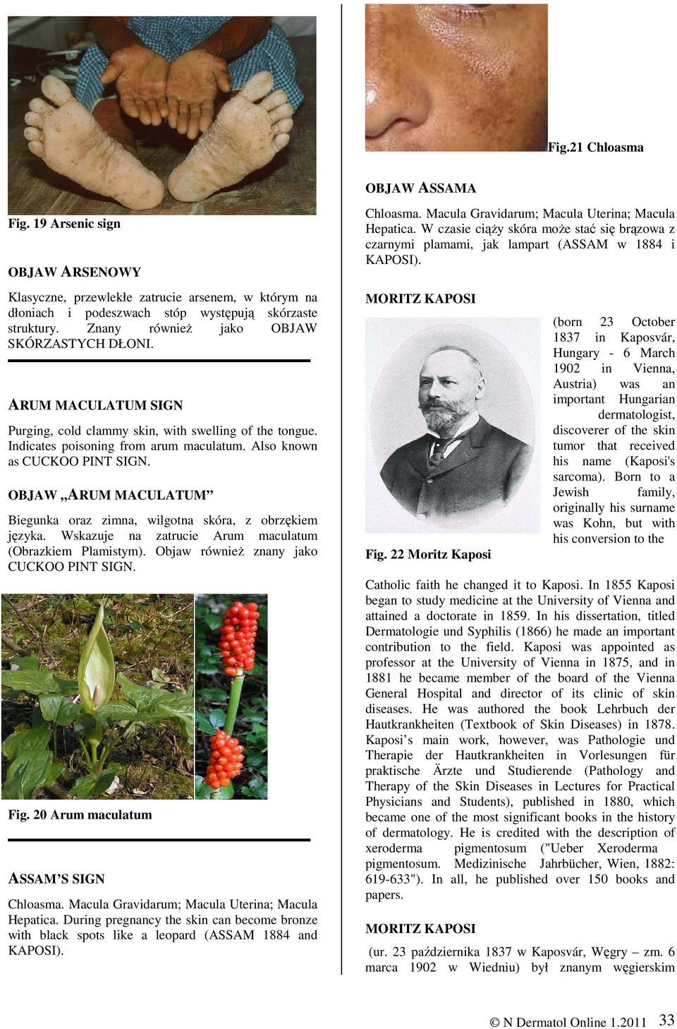 OBJAW ARUM MACULATUM Biegunka oraz zimna, wilgotna skóra, z obrzękiem języka. Wskazuje na zatrucie Arum maculatum (Obrazkiem Plamistym). Objaw równieŝ znany jako CUCKOO PINT SIGN. Fig.